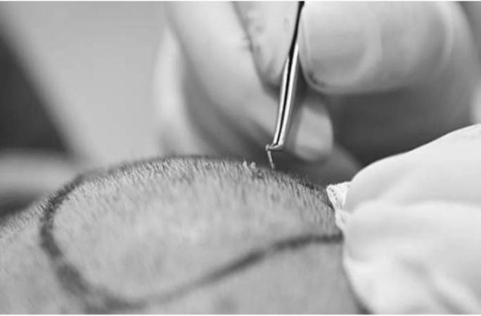 Essential Steps to Take Before Your Surgery