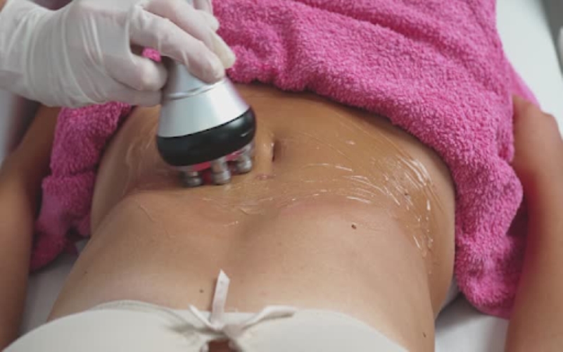 Smooth and Confident Your Guide to Effective Cellulite Removal in Singapore