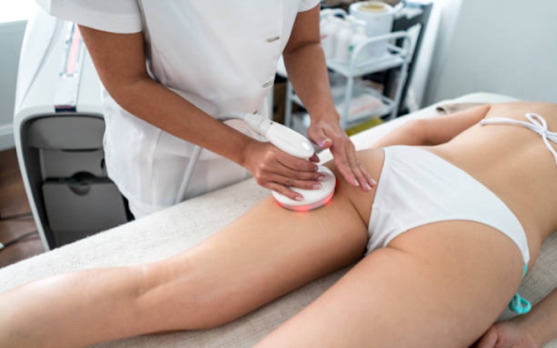 Smooth and Confident Your Guide to Effective Cellulite Removal in Singaporev