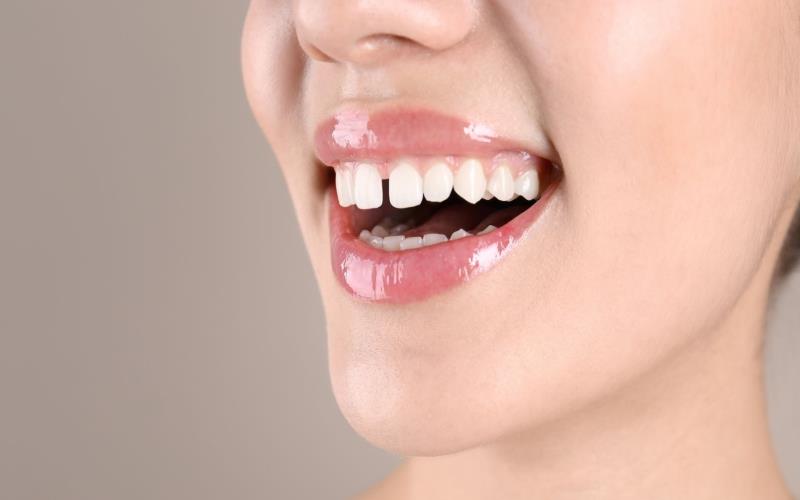 Gaps in Your Smile: Understanding the Broader Implications of Tooth Loss